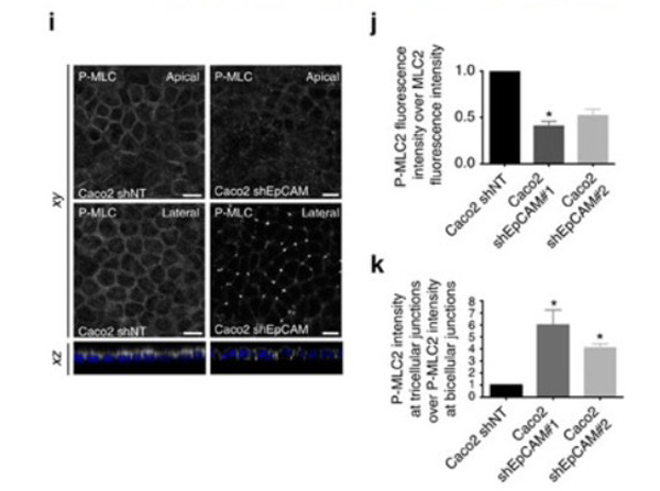 Immunofluorescence using pMLC